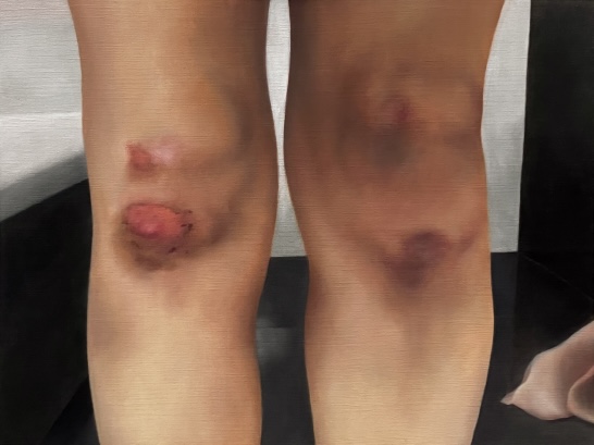 Knees