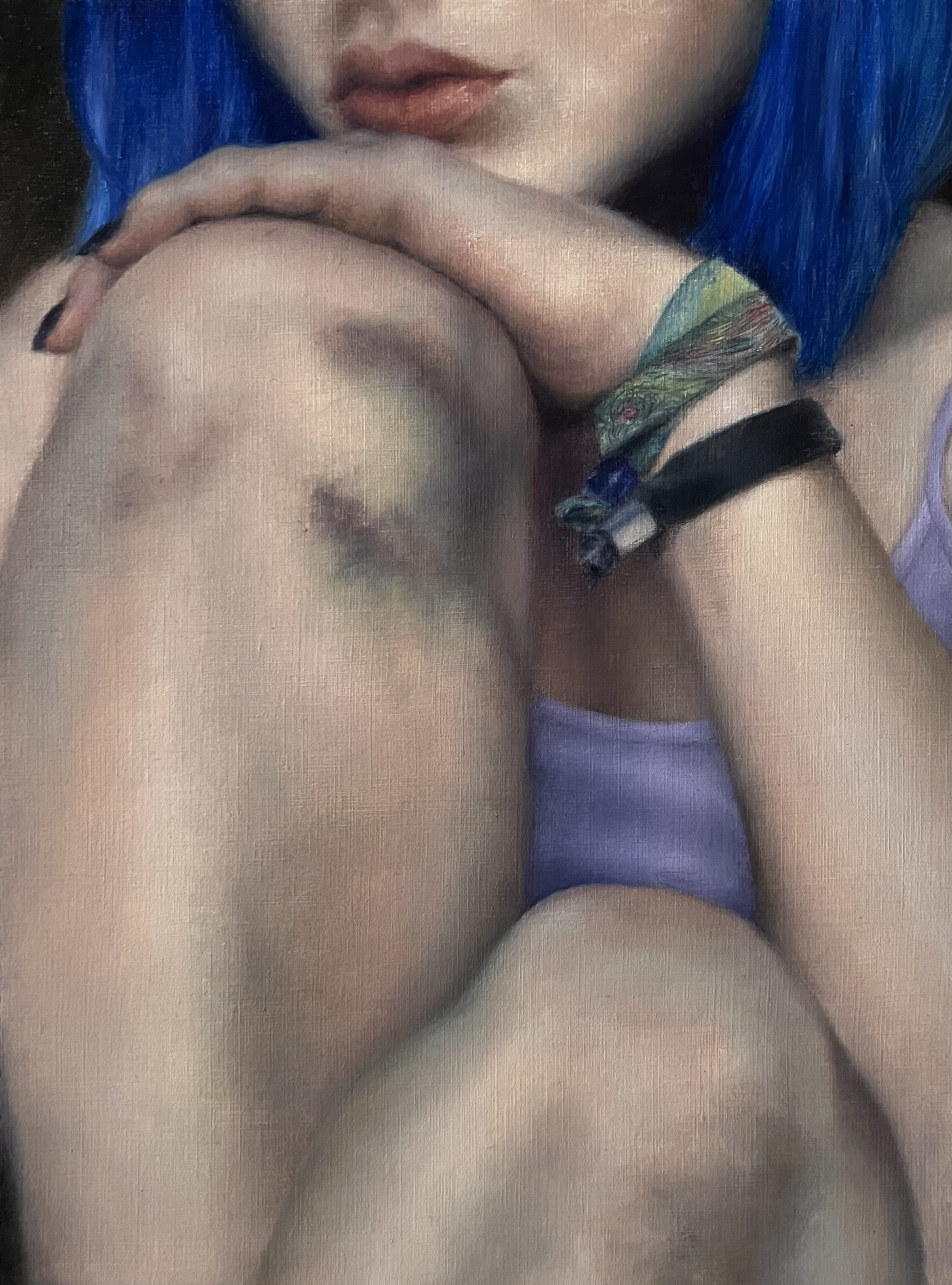 Knees II